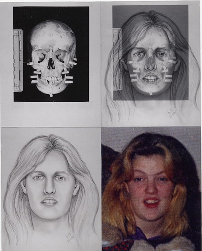 Forensic Facial Reconstruction - © Attention Deficit Disorder Prosthetic Memory Program