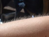 Goose bumps - © Attention Deficit Disorder Prosthetic Memory Program