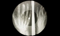 Ribs Recordings - © Attention Deficit Disorder Prosthetic Memory Program
