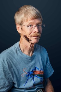 Schmidt Sting Pain Index - © Attention Deficit Disorder Prosthetic Memory Program