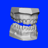 Tooth Universal Numbering System - © Attention Deficit Disorder Prosthetic Memory Program