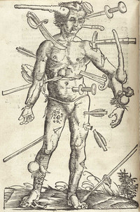 Wound Man - © Attention Deficit Disorder Prosthetic Memory Program