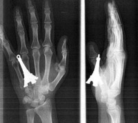 X-Ray Oddities - © Attention Deficit Disorder Prosthetic Memory Program